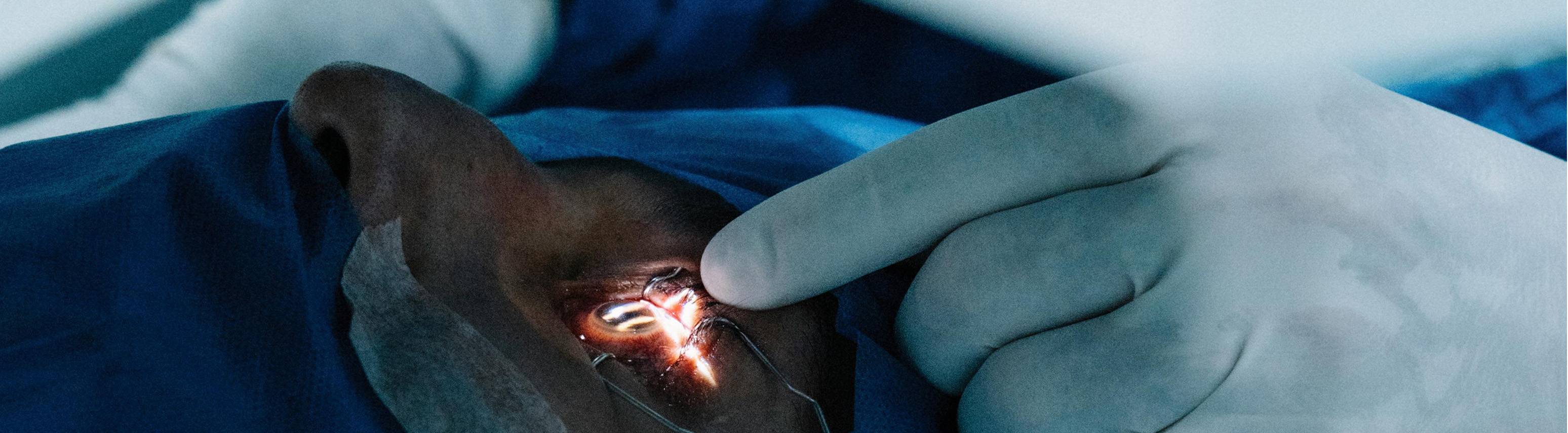 CIRURGIA DE L’APARELL LACRIMAL